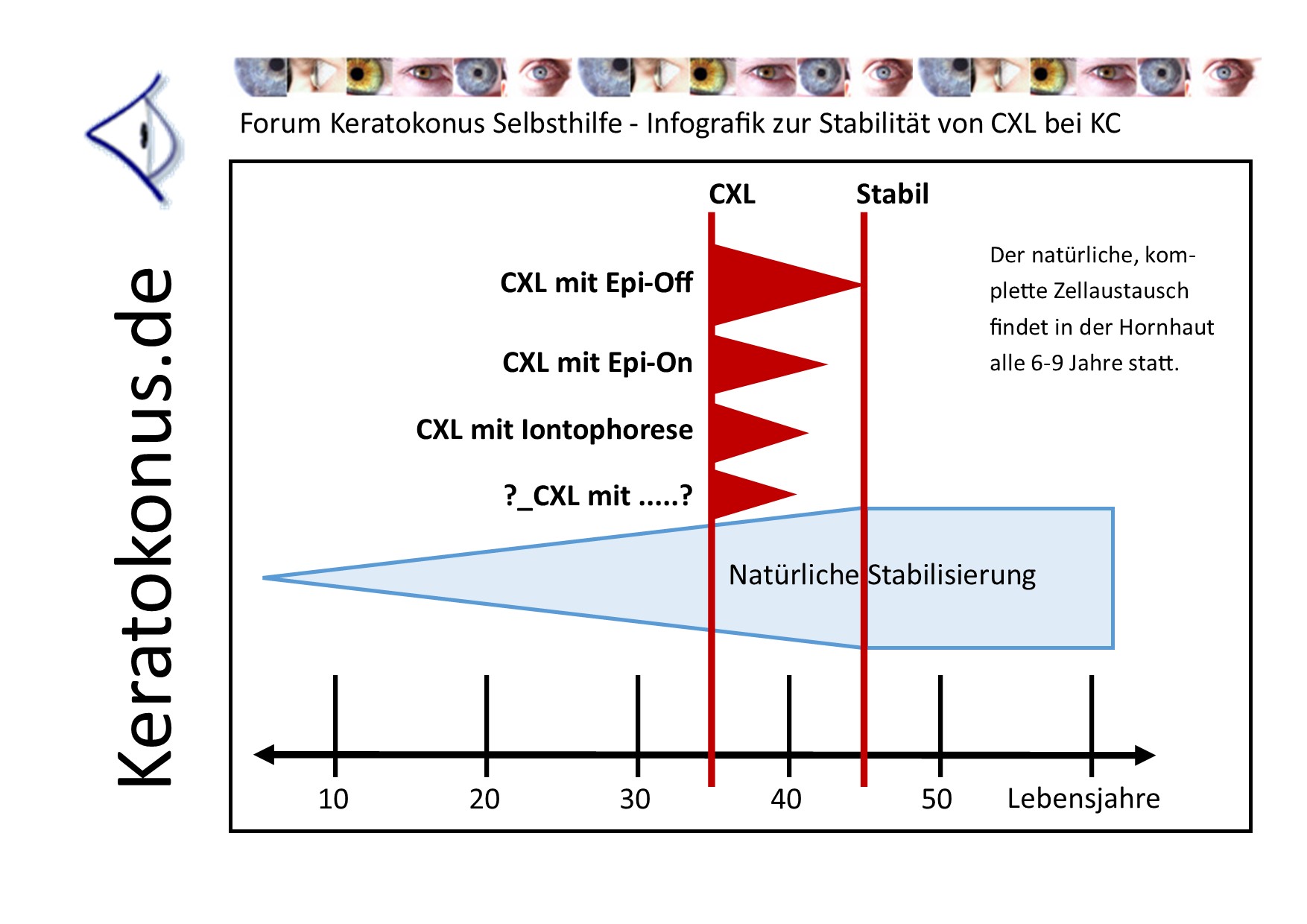 KC   copyright by Keratokonus de   how long lasts clx 001